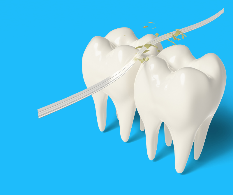 blog art dentica duże zdj (15)