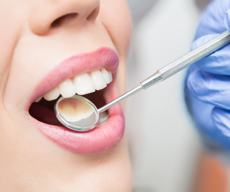 blog art dentica duże zdj (16)