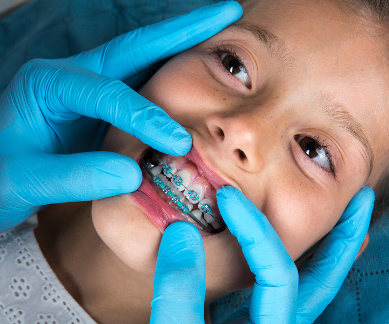 blog art dentica duże zdj (18)