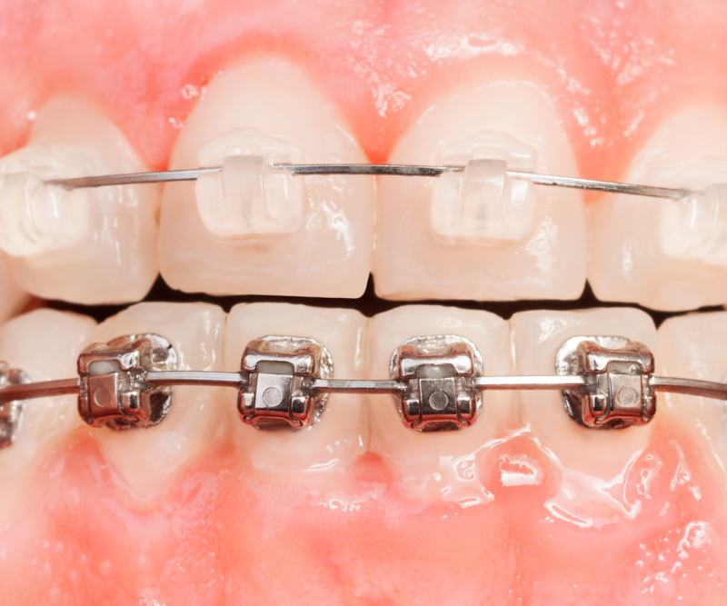 blog art dentica duże zdj (19)