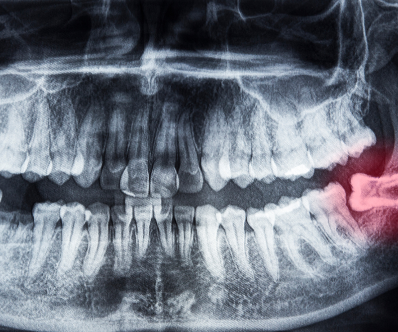 blog art dentica duże zdj (21)
