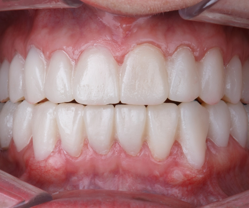 blog art dentica duże zdj (23)