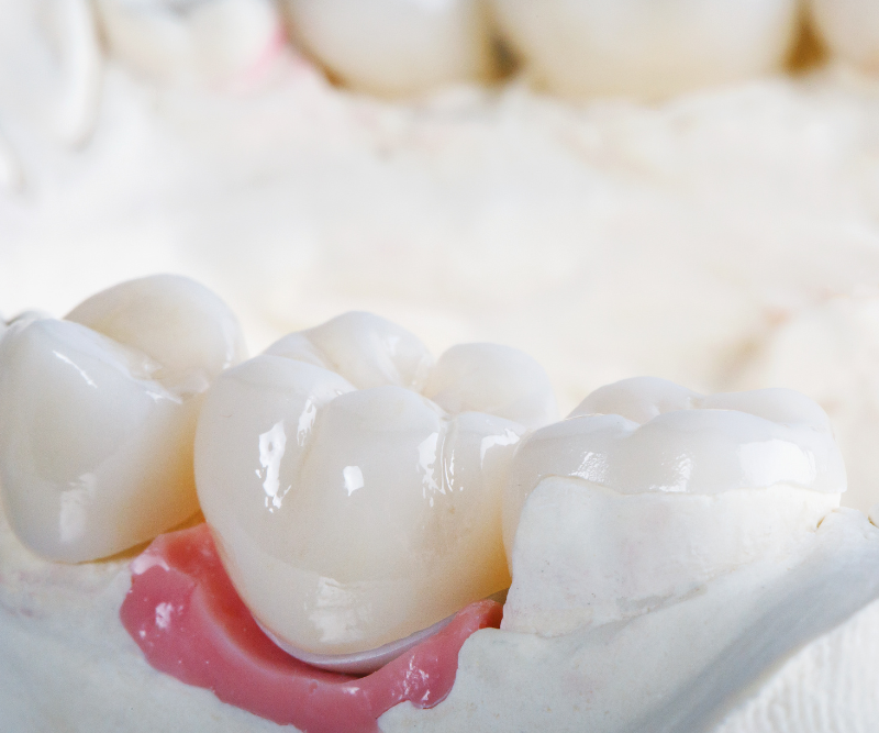 blog art dentica duże zdj (27)