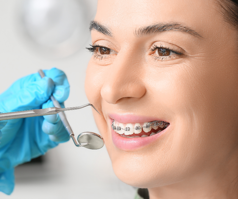 blog art dentica duże zdj (55)