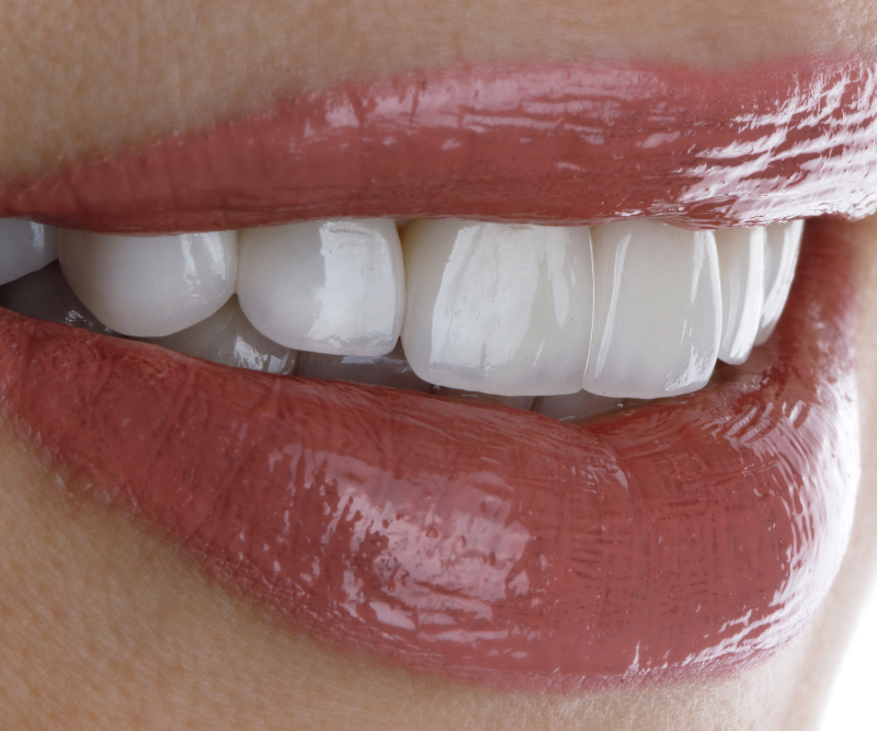 blog art dentica duże zdj (43)