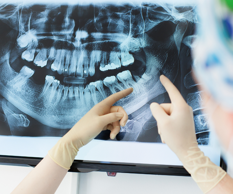 blog art dentica duże zdj (45)