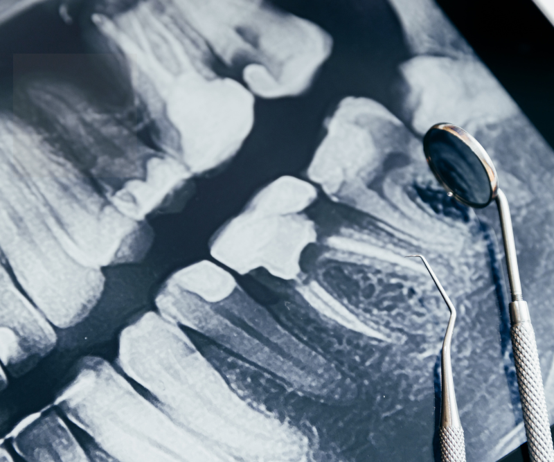 blog art dentica duże zdj (47)