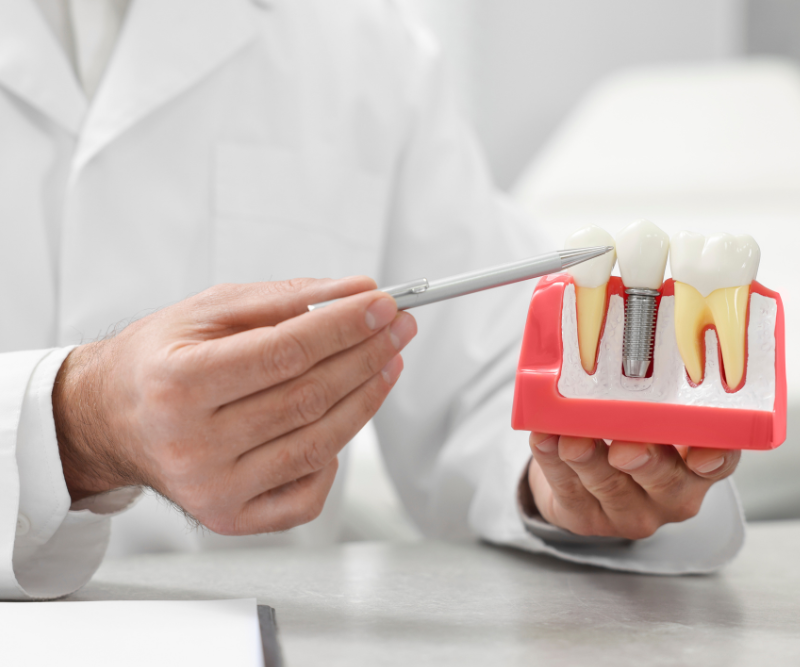 blog art dentica duże zdj (48)