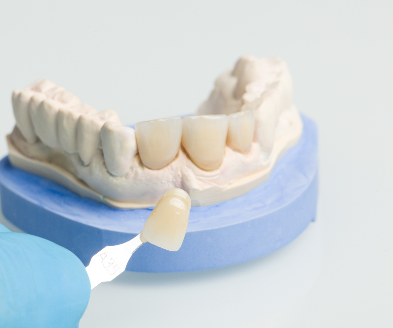 blog art dentica duże zdj (54)