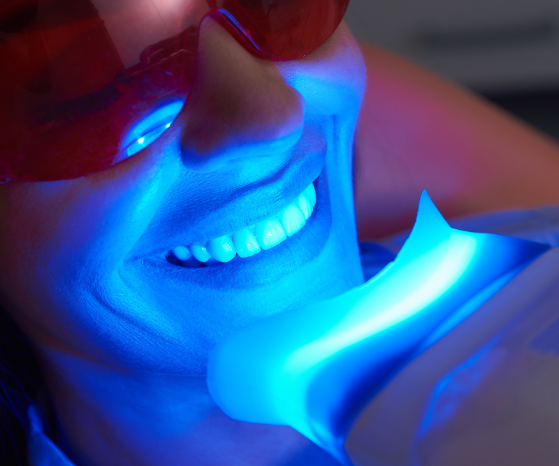 blog art dentica duże zdj (57)