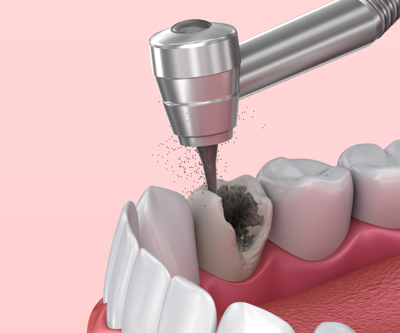 blog art dentica duże zdj (58)