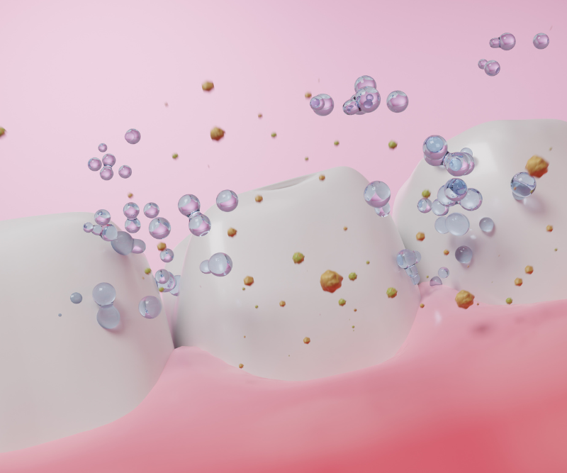 blog art dentica duże zdj (60)