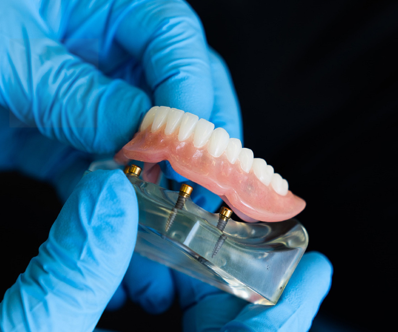 blog art dentica duże zdj (62)