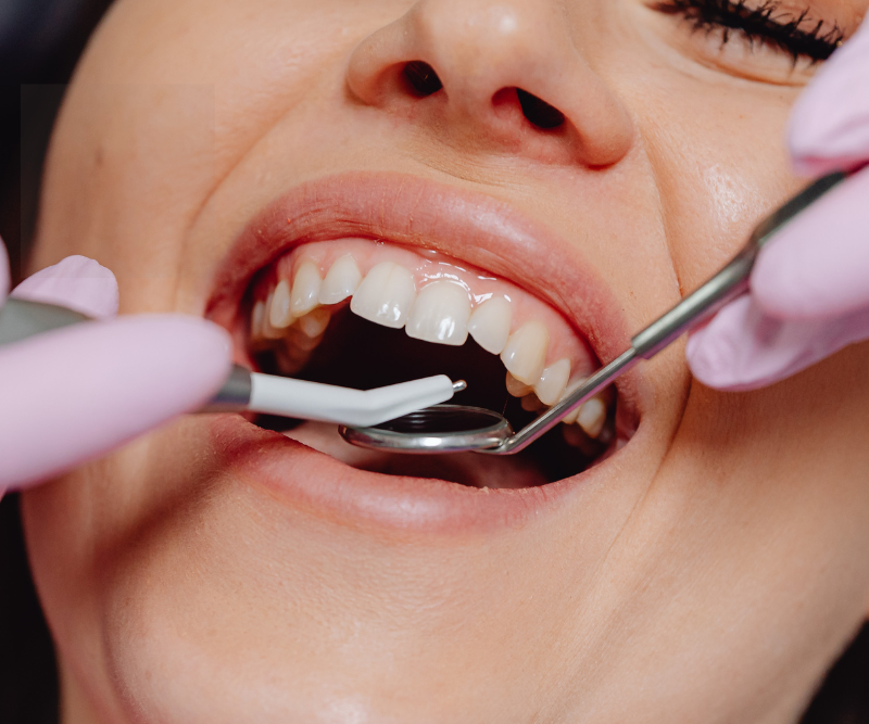 blog art dentica duże zdj (65)