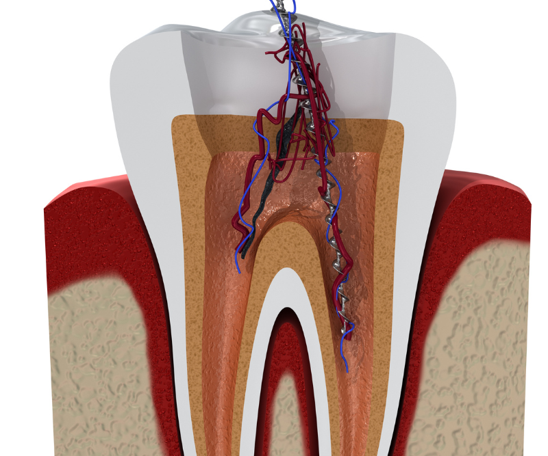blog art dentica duże zdj (73)