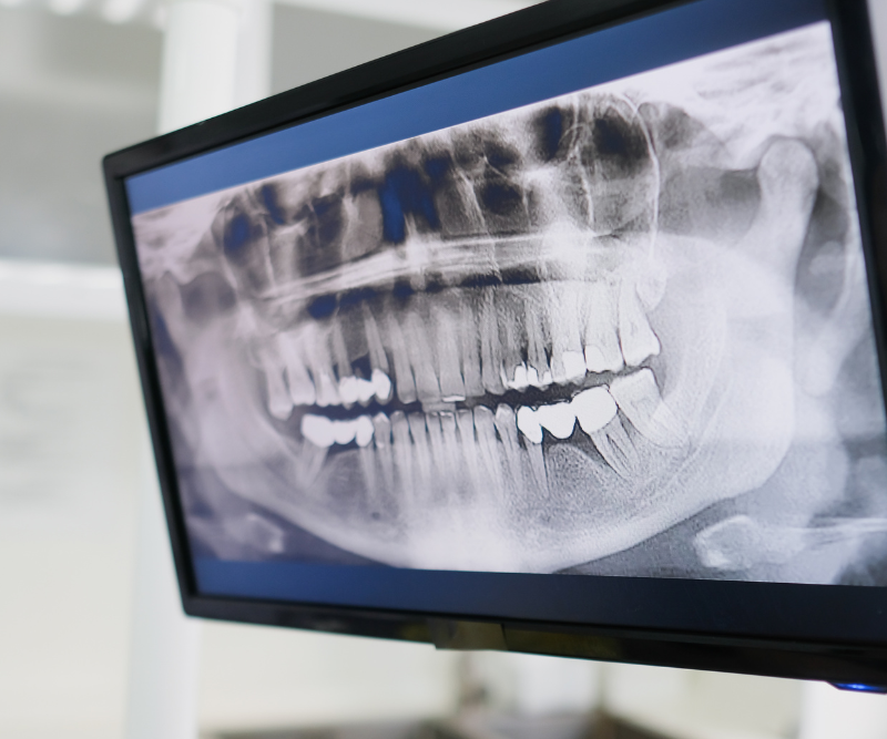 blog art dentica duże zdj (76)