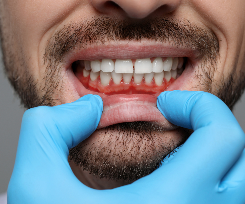 blog art dentica duże zdj (78)