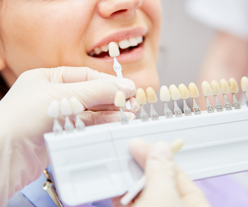 blog art dentica duże zdj (79)