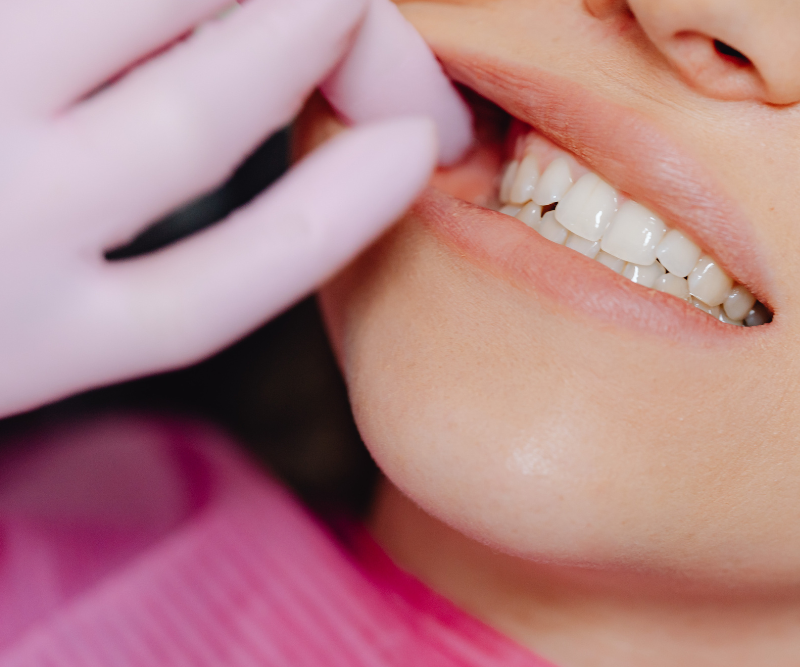 blog art dentica duże zdj (80)