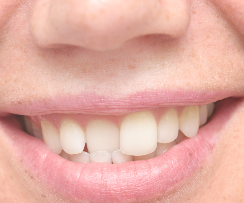 blog art dentica duże zdj (81)