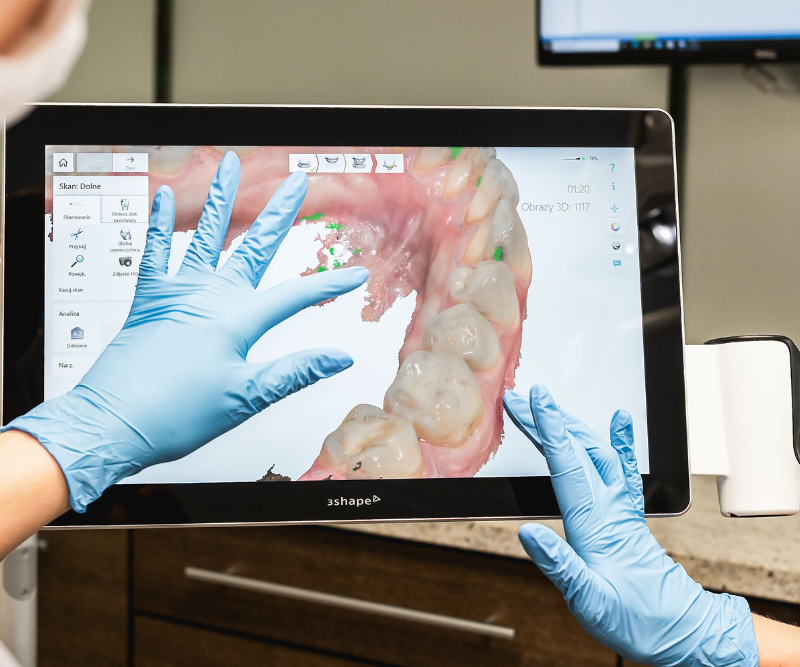 blog art dentica duże zdj (82)