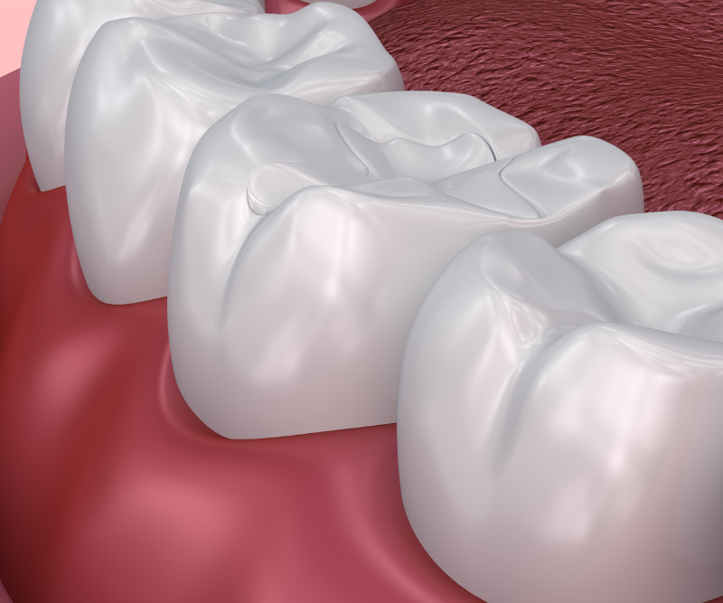 blog art dentica duże zdj (85)