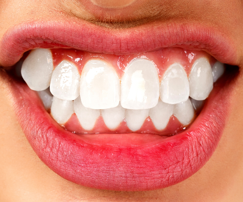 blog art dentica duże zdj (86)