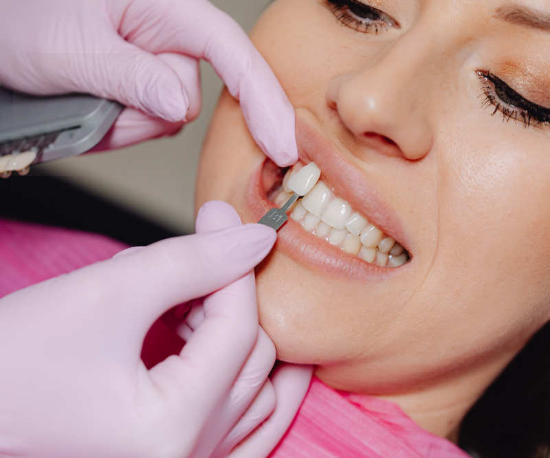 blog art dentica duże zdj (88)