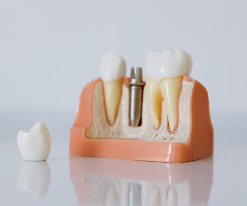 blog art dentica duże zdj (90)