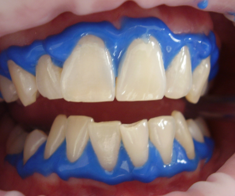 blog art dentica duże zdj (92)