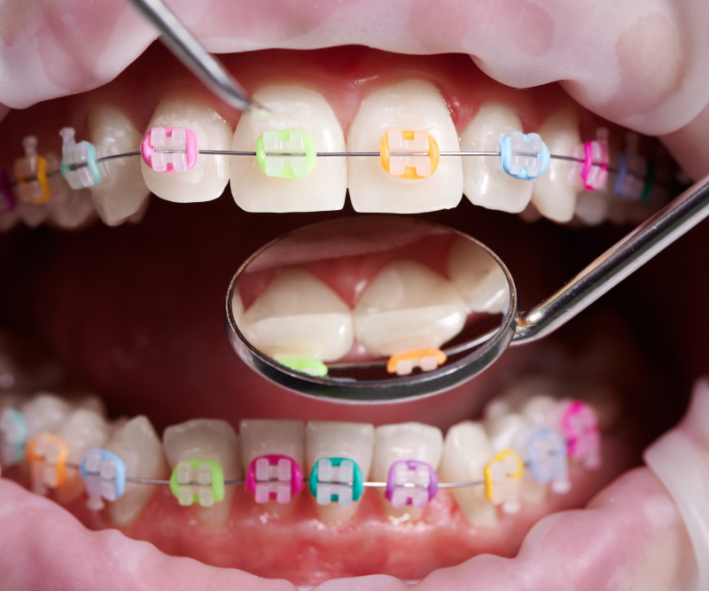 blog art dentica duże zdj (93)