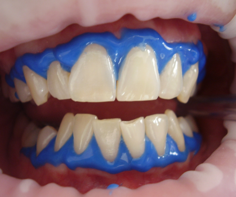 blog art dentica duże zdj - 2025-10-12T205721.160