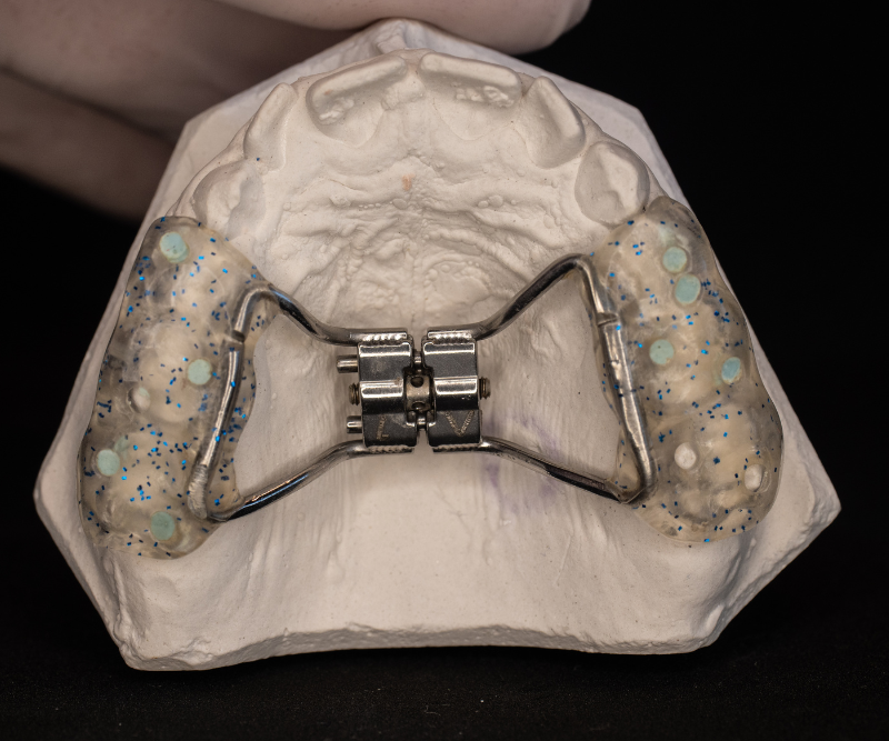 blog art dentica duże zdj - 2025-11-25T005038.495