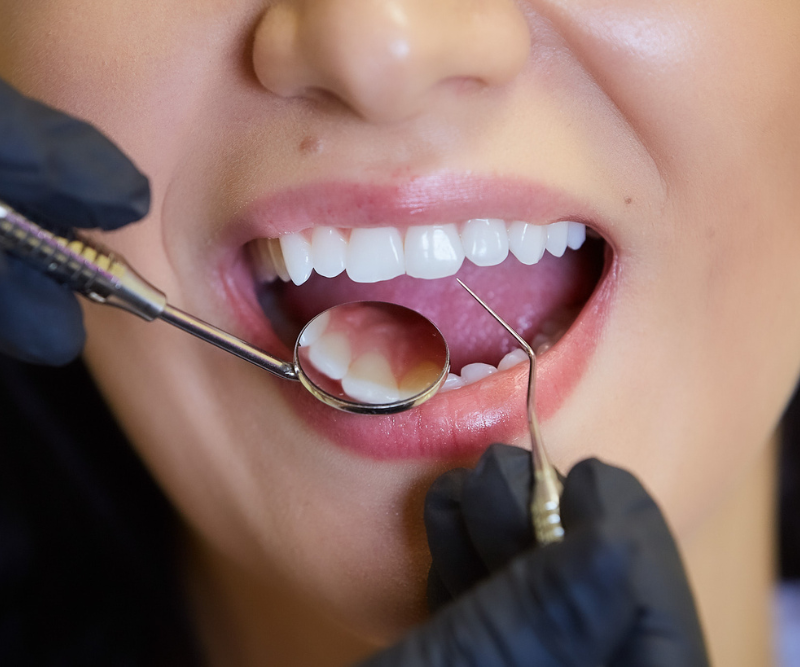 blog art dentica duże zdj - 2025-11-25T005631.912