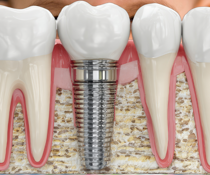 blog art dentica duże zdj - 2026-01-29T165912.523