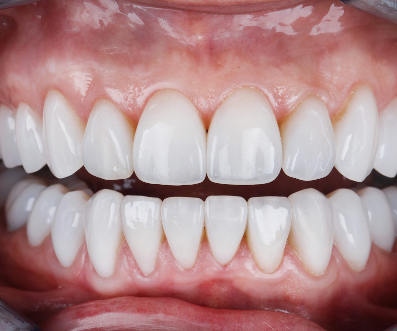 blog art dentica duże zdj - 2026-01-30T121722.025