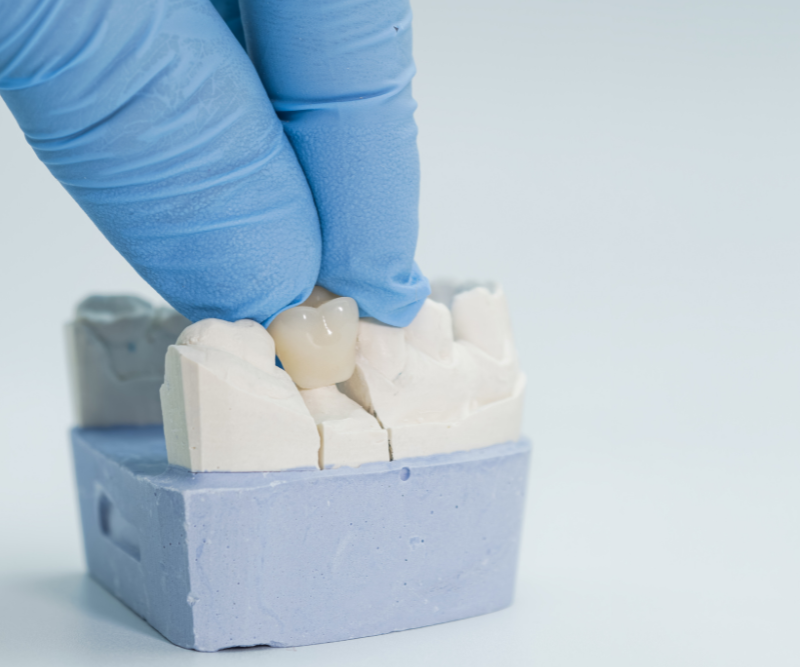 blog art dentica duże zdj - 2026-01-31T182238.280