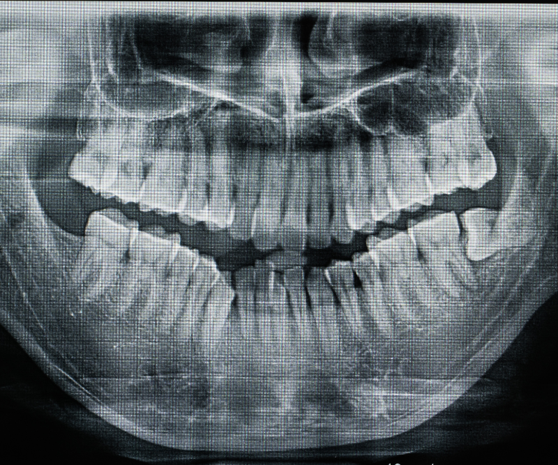 blog art dentica duże zdj - 2026-05-20T235919.970